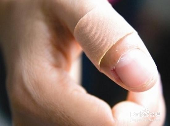 伤口有点化脓怎么办