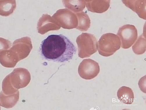 怎样辨认骨髓片子？这是哪种细胞啊？