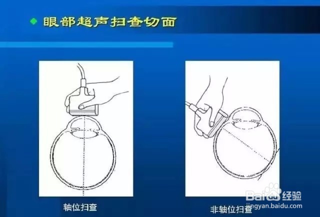 几种常见眼病B超图谱及诊断