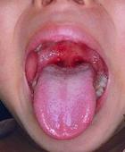 牙齿健康自测方法