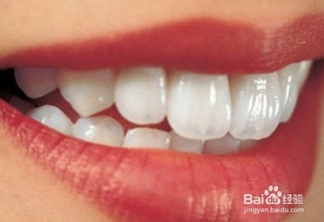 <b>怎样才能保持牙齿洁白</b>