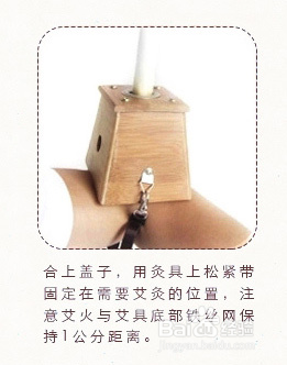 巧妙使用灸器 ，使艾灸更方便简单