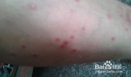 去医院时如何向医生说自己的病情?