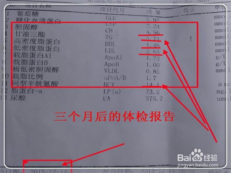 脂肪肝需要注意什么？