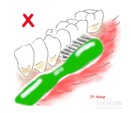 使用电动牙刷时应该注意什么