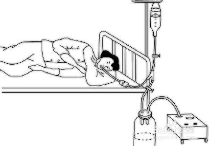 急症处理系列经验：[10]安眠药中毒