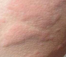 #好久不见#刮山药手痒有什么小妙招