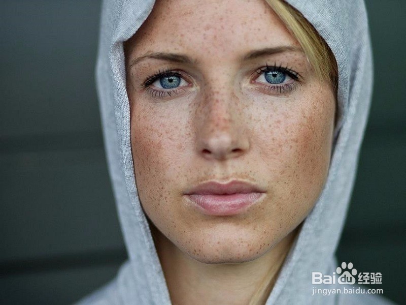 怎样去除黄褐斑