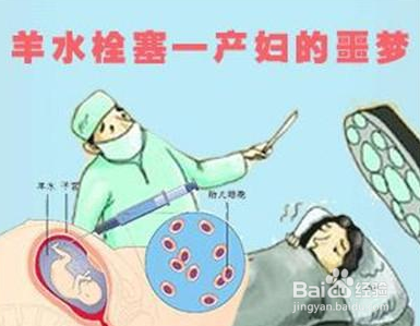 如何预防流产或分娩时羊水栓塞