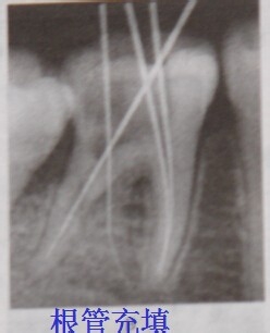 临床口腔牙体牙髓病的知识。