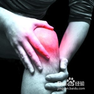 风湿病应有如何的生活方式