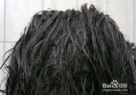 脂溢性脱发能治好吗？脂溢性脱发生发经验谈