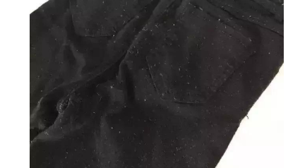 裤子掉毛怎么办