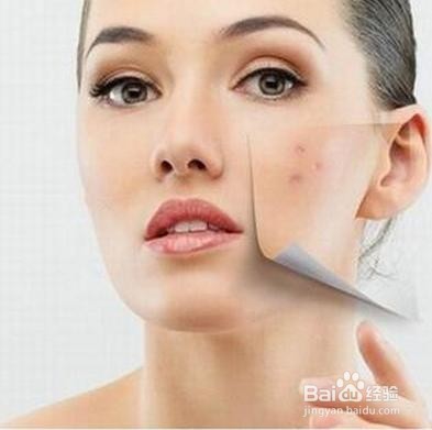 如何有效减少脸上痘痘？