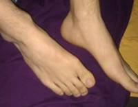 脚出汗多怎么办