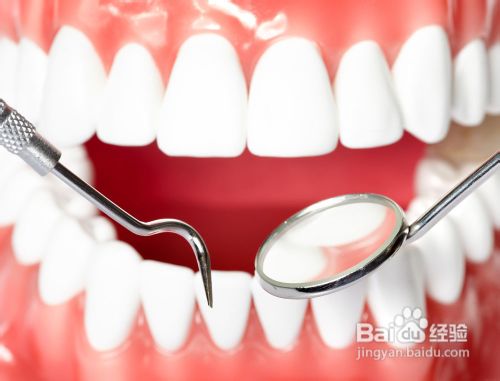 成人牙周炎该怎么治疗