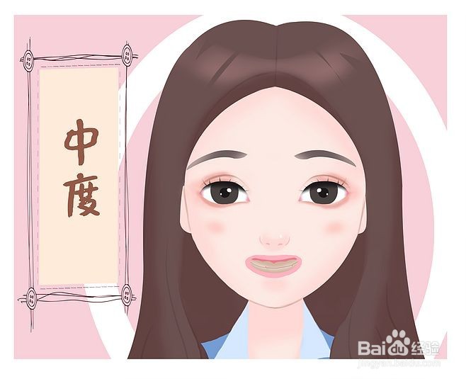 如何治疗四环素牙