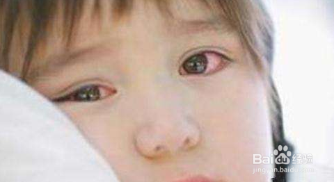 百度经验新手很容易得焦虑症，如何克服