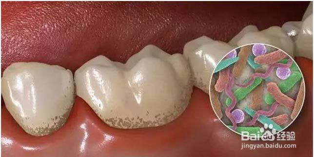 养成这些生活习惯，让你从此远离口臭的烦恼