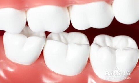 <b>引起牙齿变色的原因有哪些</b>