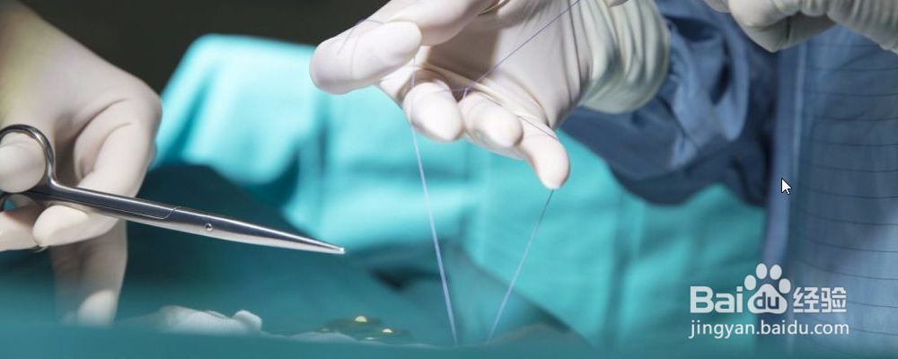 保养子宫有什么方法