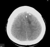 MRI的检查方法有哪些