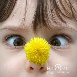宝宝斗鸡眼怎样纠正