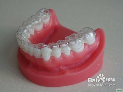 导致牙齿不齐的原因