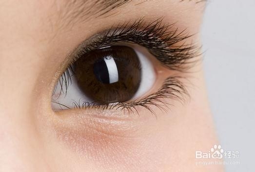 眼屎多是怎么回事