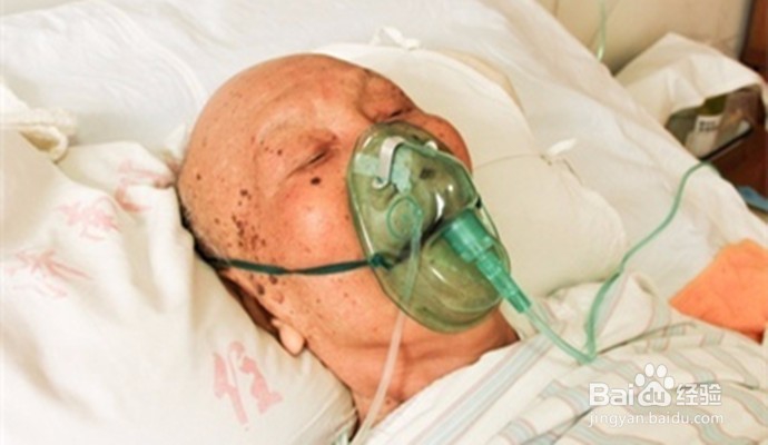 脑梗塞的患者应该注意什么？