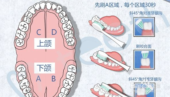 预防牙龈出血需要注意哪些方面