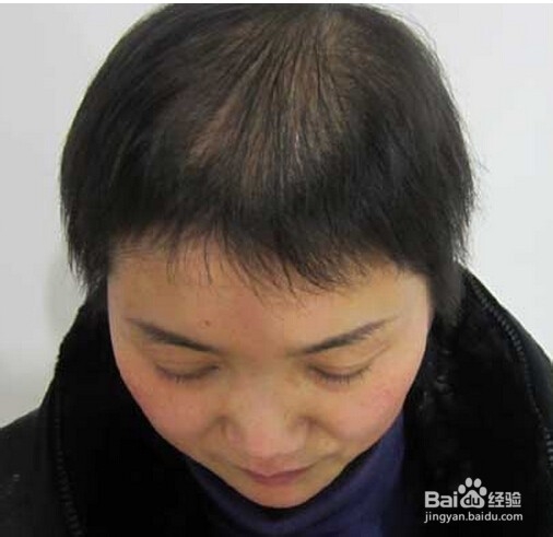 发质不好怎么办？头发问题怎么解决？