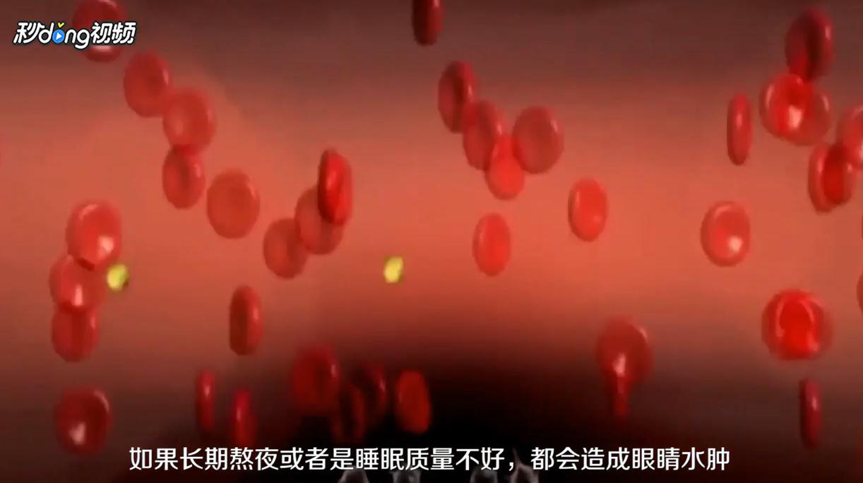 早上起床眼睛浮肿是什么原因
