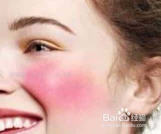 柳自涛：如何判断自己属于那种皮肤类型