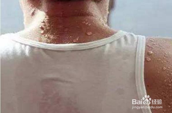 心律过快伴有出汗怎么办