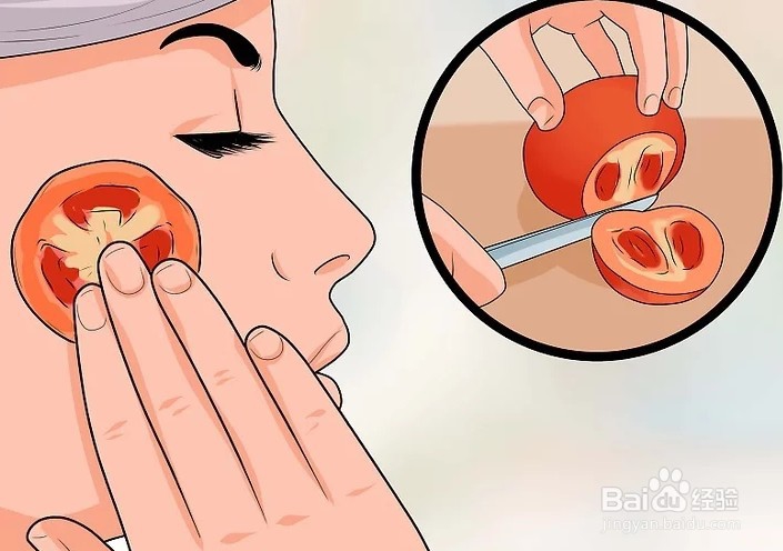 脸上长粉刺怎么办用什么方法消除