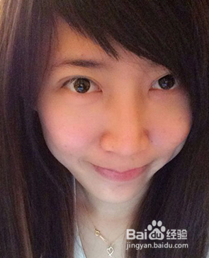 全切双眼皮效果很不错