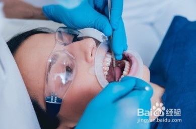 合肥种牙多少钱