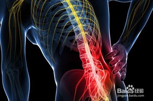 关于骨质增生，我们应该注意哪些问题？