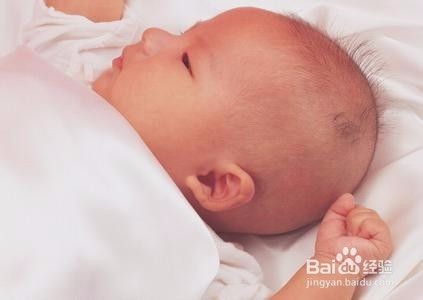 四个月宝宝有湿疹怎么办