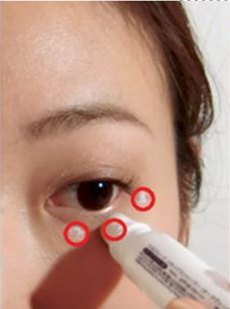 黑眼圈很重怎么办