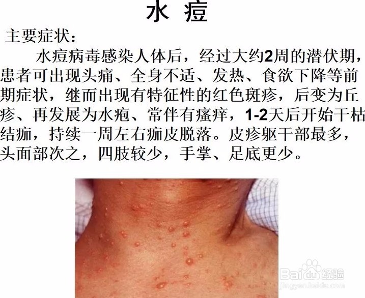 春季传染病有哪些,学生怎么预防