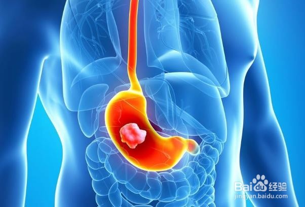 影响男性的最常见类型的癌症