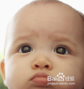 夏天宝宝生了痱子该怎么办