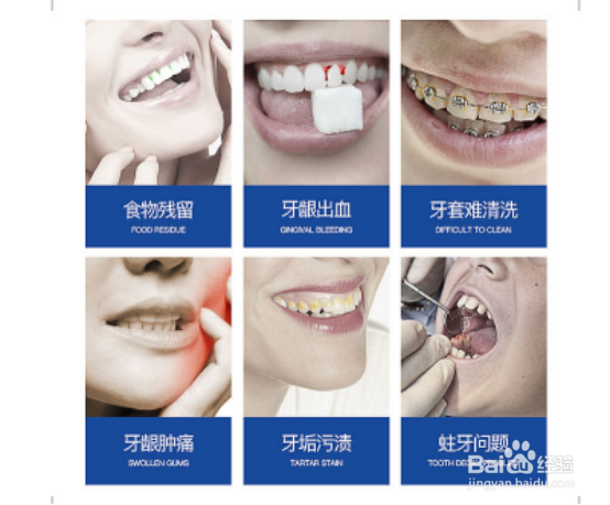 冲牙器（水牙线）辅助清洁口腔，冲牙器怎么使用