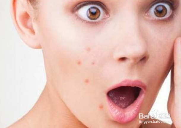 怎么祛痘痘最有效的方法