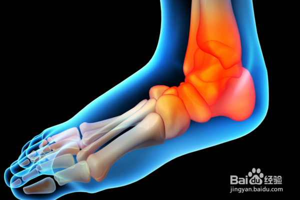 在家轻松治疗各种疼痛