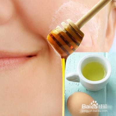 怎样去除面部黄褐斑