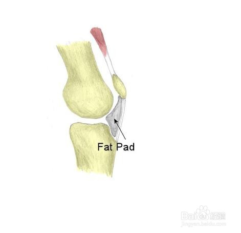 治髌骨软化症的方法
