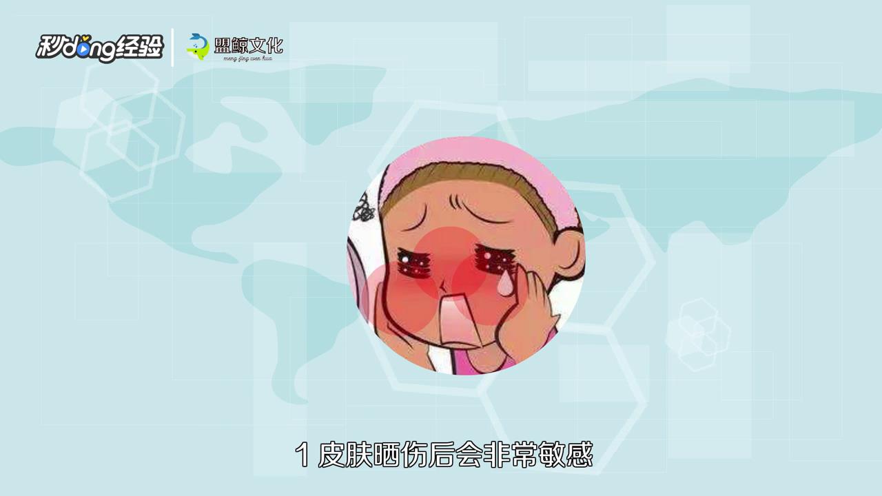 军训皮肤晒伤了怎么办